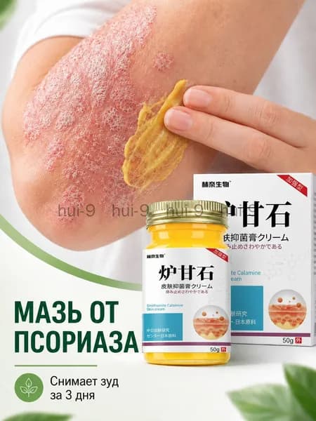 Мазь от псориаза с каламином, крем от зуда и шелушения кожи, для пожилых людей и детей, 50 г