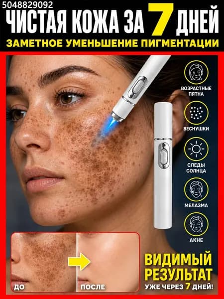 Лазерная ручка для комплексной терапии угревой сыпи на лице, Снижение выраженности застойной пигментации и высыпаний, Устройство для домашнего ухода в паре с кремом с микроиглами для лица