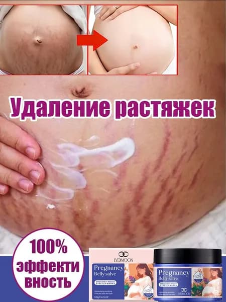 Беременный крем для живота от растяжек, интенсивное увлажнение, устранение стрий на коже