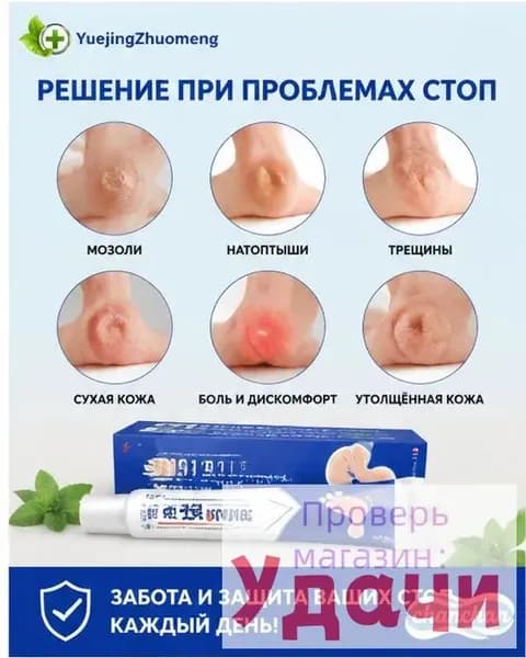 Средство от шипиц, натоптышей и сухих стержневых мозолей на ногах мазь и гель Корнекс,эффективное китайское средство