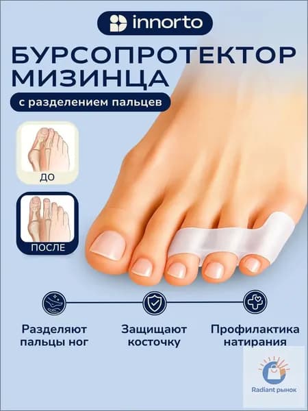 Бурсопротектор мизинца с межпальцевыми перегородками. Разделители для пальцев ног силиконовые 50402