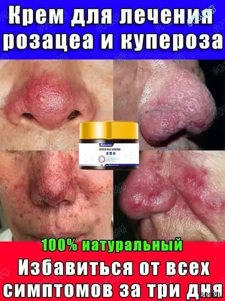 крем от купероза для лица для чувствительной 30 г