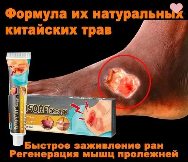 Мазь от пролежней регенерирующая 20г, при покраснениях, язвах и открытых ранах, Быстрое заживление для лежачих больных, после операций и у пожилых.