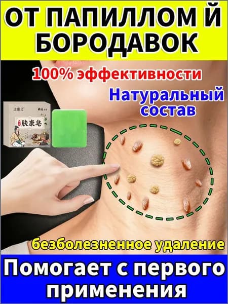 Мазь от нитевидных и плоских бородавок, висячих родинок