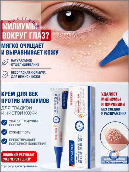 Популярная мазь для ликвидации жировых гранул, удаление милиумов под глазами и на веках выполняется посредством премиум крема