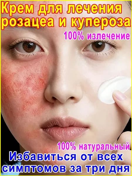 Крем для лица от купероза, розацеа, покраснений "Тонус-Капилляр Лица".для проблемной кожи,100% натуральный В безгормональном составе.20 мл