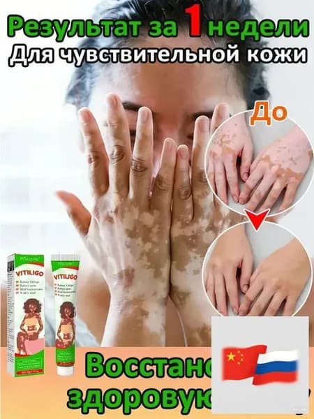 Мазь от витилиго,Средство при нежелательной пигментации витилиго.100 мл