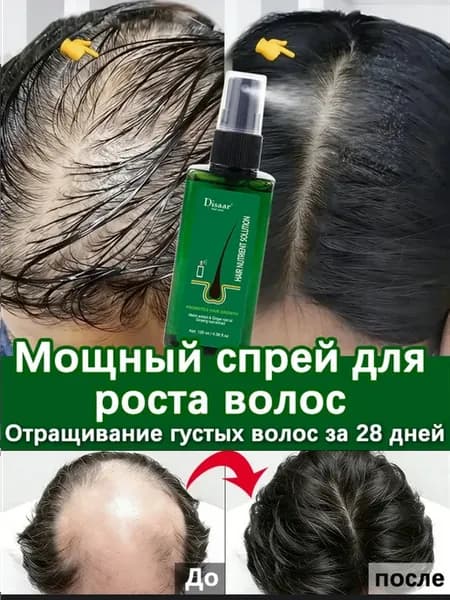 Спрей для роста волос и предотвращения выпадения, 120 мл