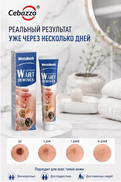 крем от бородавок и папиллом, средство для удаления сухих мозолей и натоптышей, уход за кожей рук и ног, 20 г