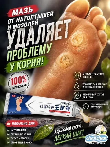 Мазь от мозолей стержневых и натоптышей 20 г; китайский крем для удаления бородавок, шипицы и сухих мозолей, эффективное средство от подошвенных бородавок на ногах с экстрактами трав