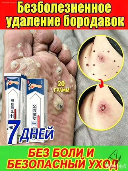 Мазь от бородавок и папиллом - комплексное средство для удаления подошвенных и плоских образований, полное очищение поверхности кожи от наростов, восстановление гладкости , 20 г