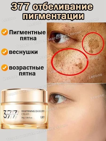 377 Kрем против пигментных пятен и веснушек,отбеливающий от пигментации,Ночной и дневной для кожи лица и тела,чувствительной и нормальной кожи лица,успокаивающий разглаживания и увлажнения кожи,30г