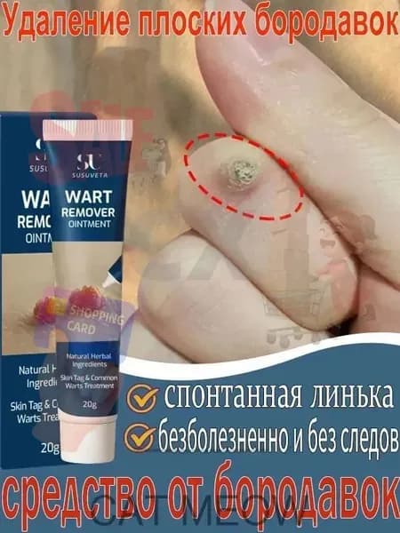 Средство от папиллом и бородавок(Совершенно новая версия ), для удаления бородавок папиллом, сухих мозолей на ногах и теле, мазь для ухода за кожей, безболезненно, не оставляет следов 20 г